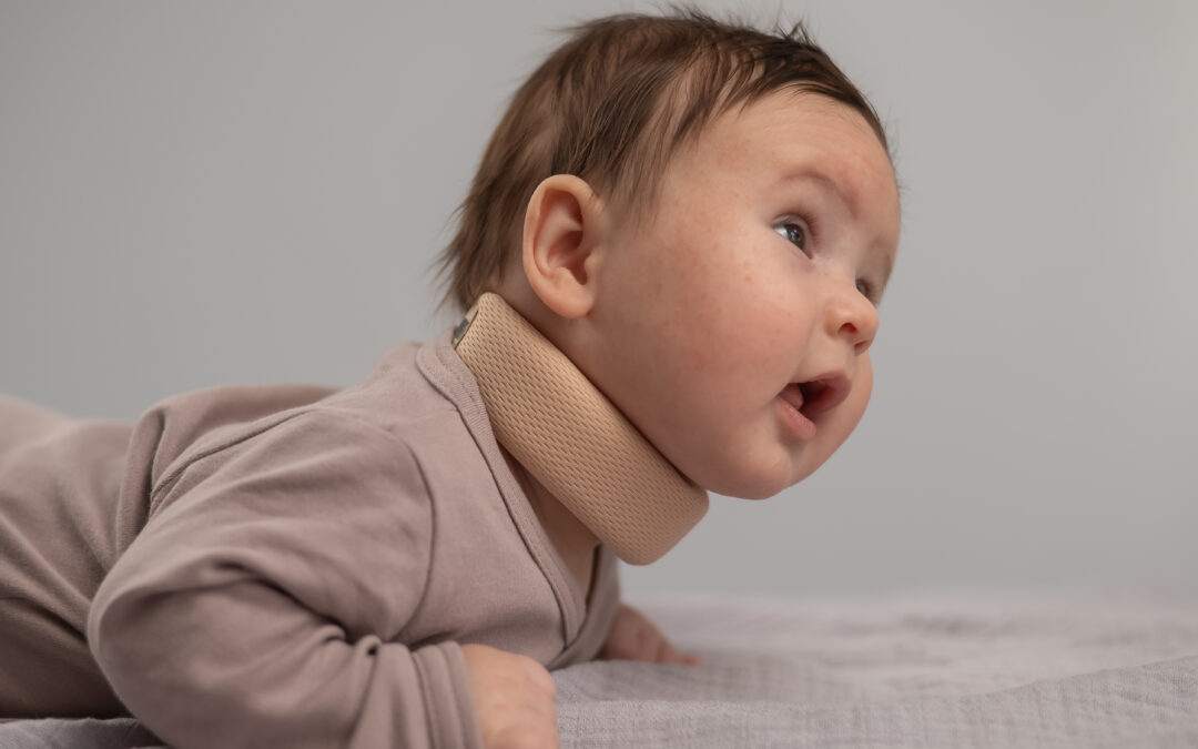 A parent’s guide to pediatric torticollis treatment