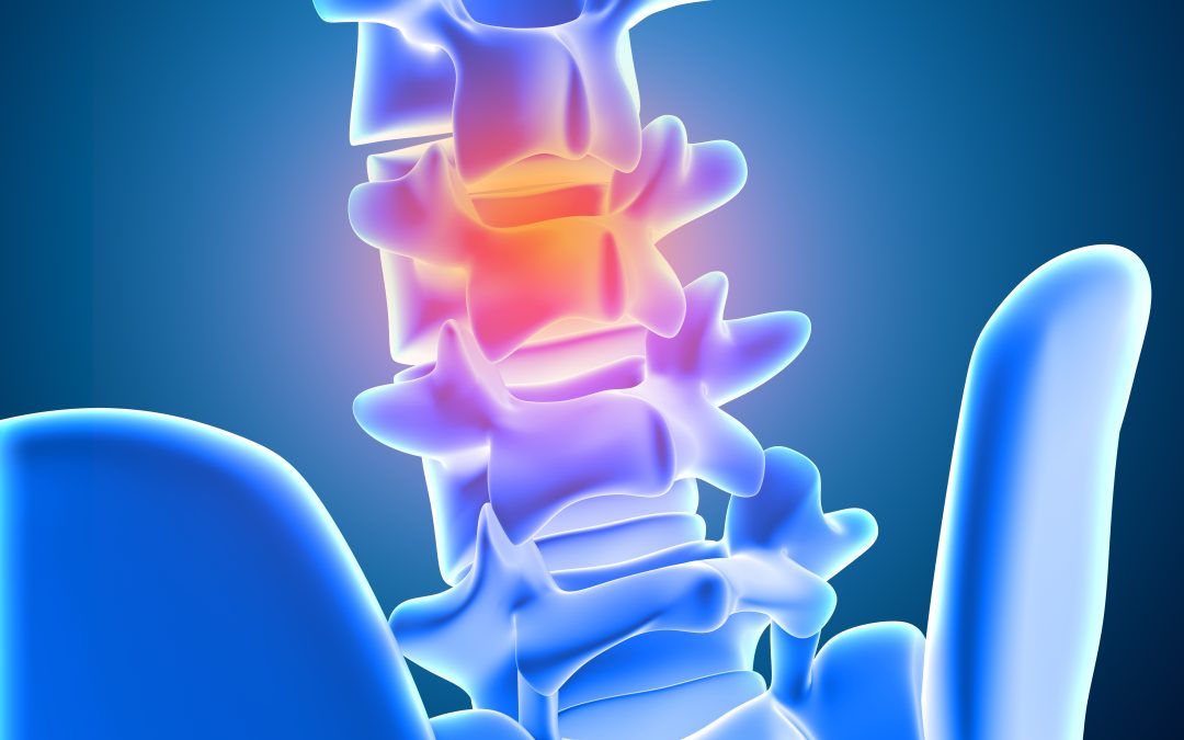 Relief for Pain from Bone Spurs in Back: 7 PT Solutions