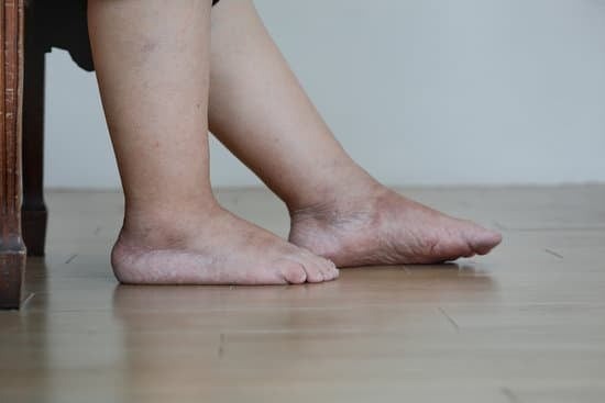 Swollen Feet and Ankles: 9 Top Causes & The Best Physical Therapy Solutions